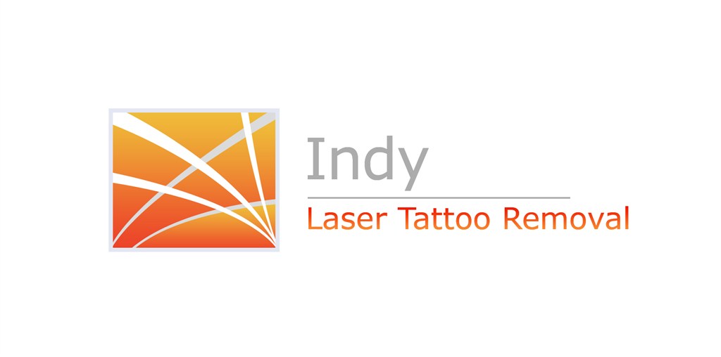 Indy Laser Tattoo Removal | Indianapolis, IN 46260 | Angies List